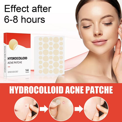 Hydrocolloid Acne Pimple Patches – 144 PCS