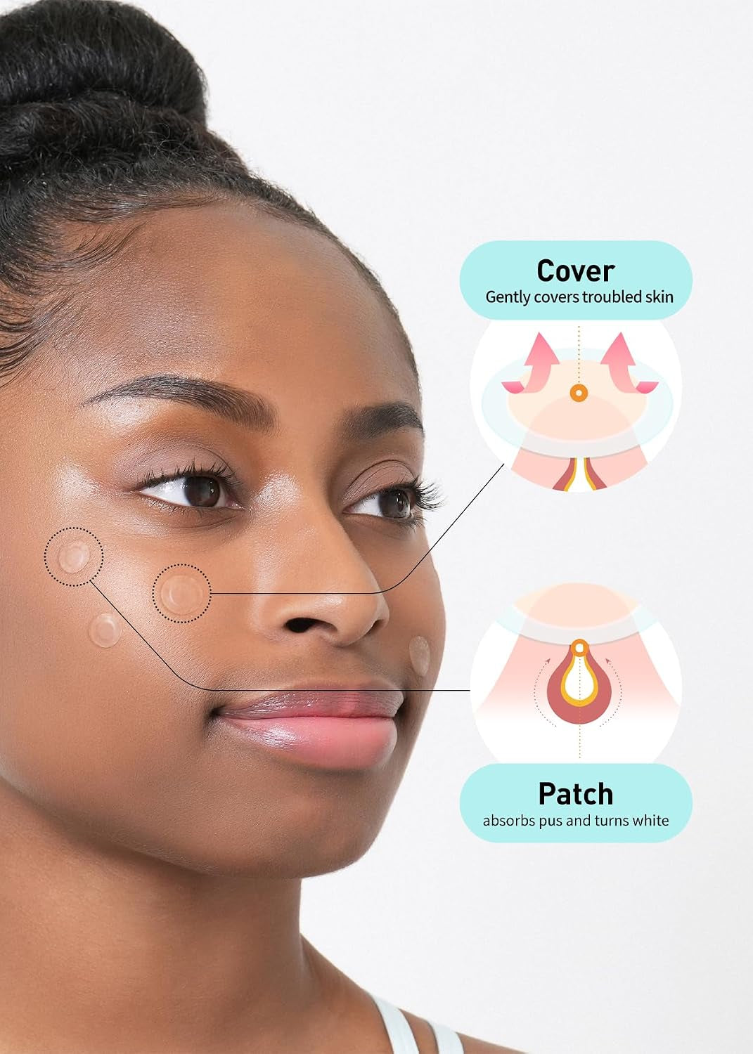 Care Plus Hydrocolloid Acne Pimple Patches | Invisible Korean Spot Patches (306 Count)