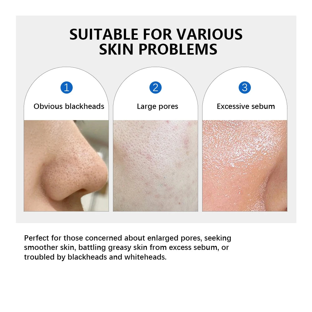 4.5% AHA + 0.45% BHA Pore Toner Pads | Dual-Textured Exfoliating Facial Pads for Clear & Smooth Skin