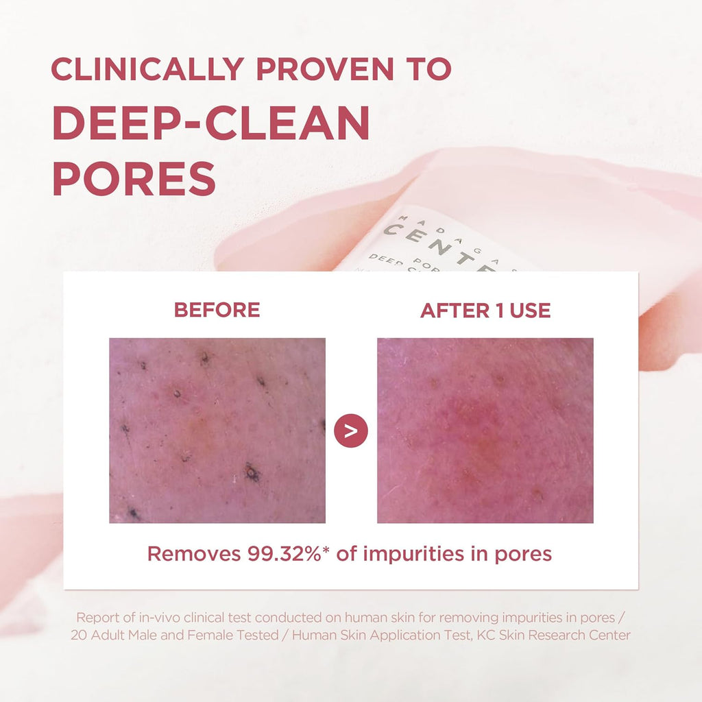 Hudson's Pick Poremizing Deep Cleansing Foam – Himalayan Pink Salt & Centella Face Cleanser (125ml / 4.23 fl oz)